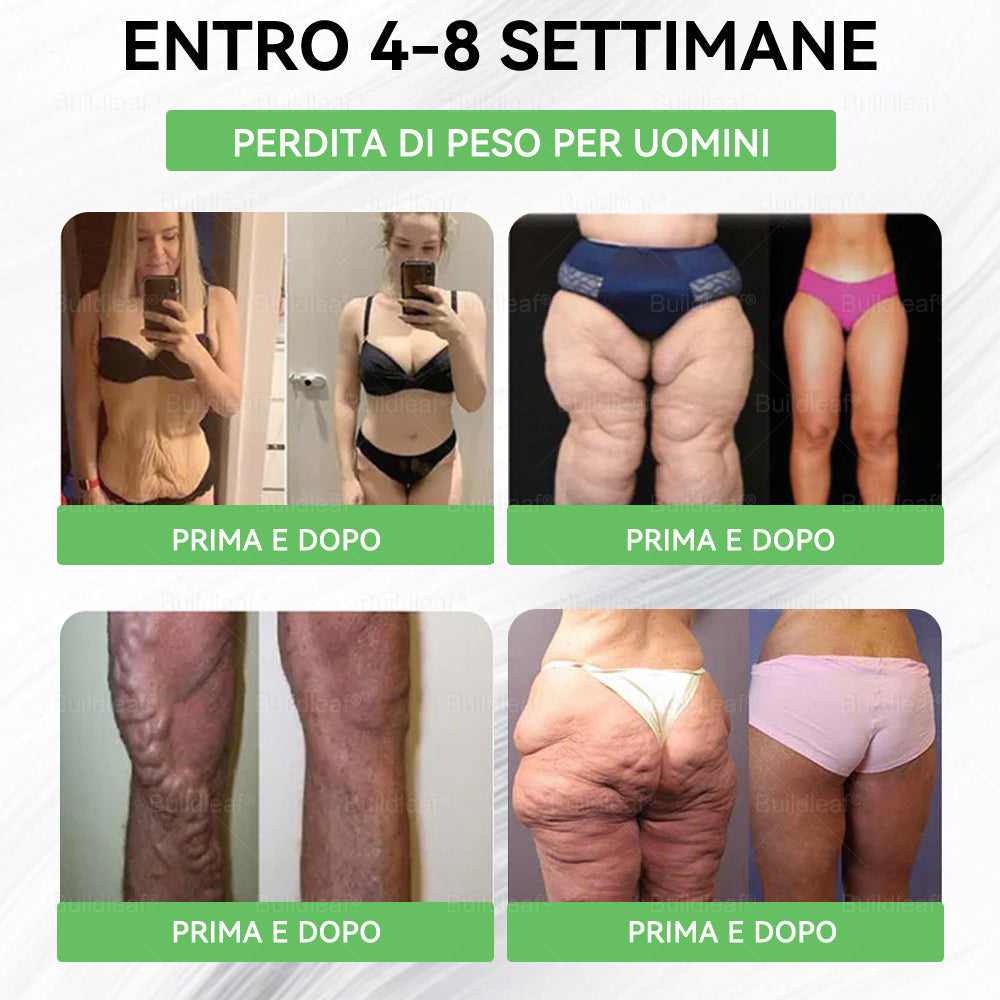 Negozio ufficiale | ššBuildLeafĀ® GLP-1 8-in-1 Fit & Vital Soluzione Orale (Solo una volta al giorno, cambiamenti visibili in 7 giorni) ā
Per obesitĆ , salute cardiovascolare, diabete, apnea notturna, salute intestinale, problemi articolari e altro