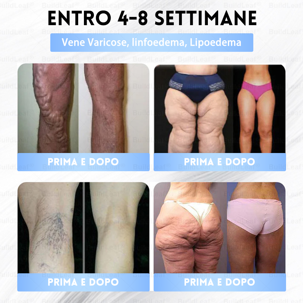 BuildLeaf® ha una sorpresa speciale solo per te! Hai già ricevuto un'offerta incredibile, ma adesso ne hai sbloccata una ancora migliore: Avrai un fantastico 50% di sconto sul tuo prossimo acquisto – solo per i prossimi due minuti!